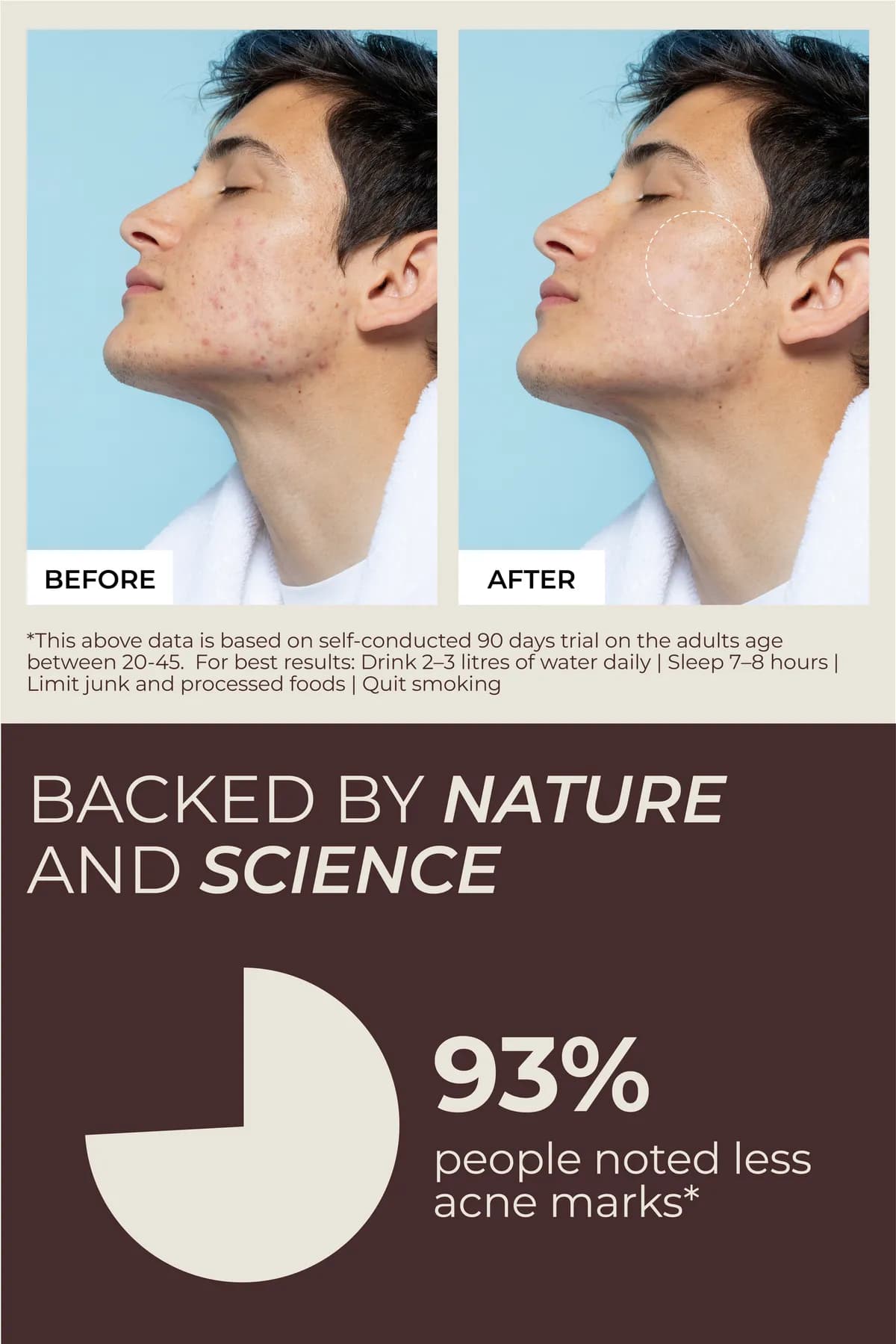 Before and after: 93% of people noted less acne marks